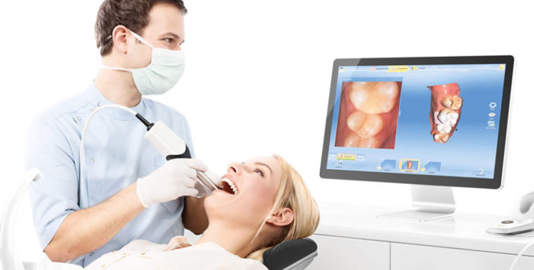 Cerec-768x389